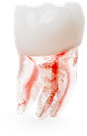 Endo
